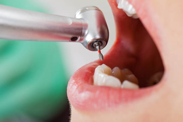 Best Emergency Denture Repair in Preston, ID